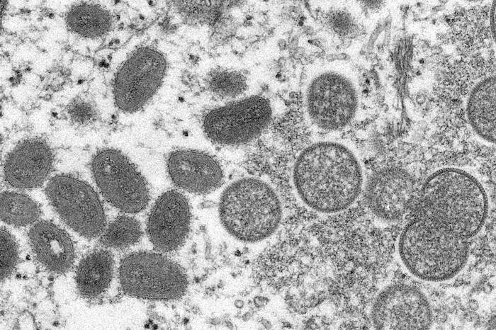 Esta imagen captada con un microscopio electrónico en 2003, proporcionada por los Centros para el Control y la Prevención de Enfermedades de Estados Unidos (CDC, por sus siglas en inglés), muestra viriones maduros de viruela símica en forma de óvalo, a la izquierda, y viriones inmaduros esféricos, a la derecha, obtenidos de una muestra de piel humana.